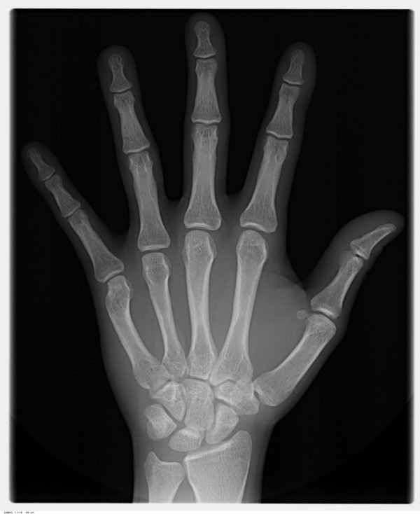 Carpal-600x734