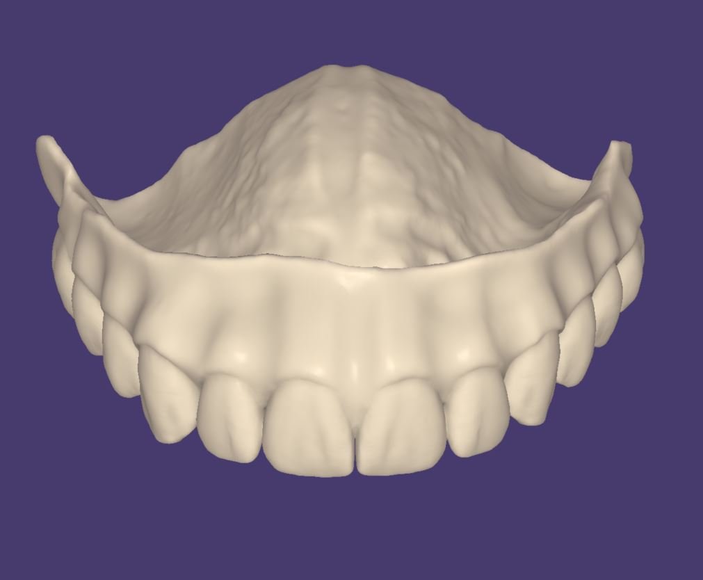 montagem-de-dentes-impresso